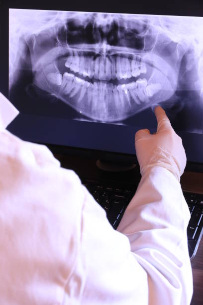 Best Emergency Dental Extractions in Hillcrest Heights, MD